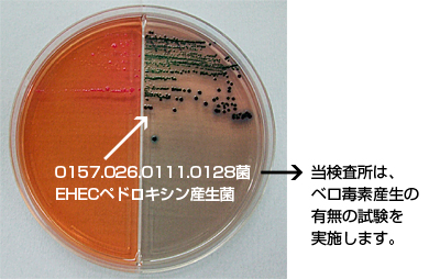 O157.O26.O111.O128菌 ＥＨＥＣベロドキシン産生菌  当検査所は、ベロ毒素産生の 有無の試験を実施します